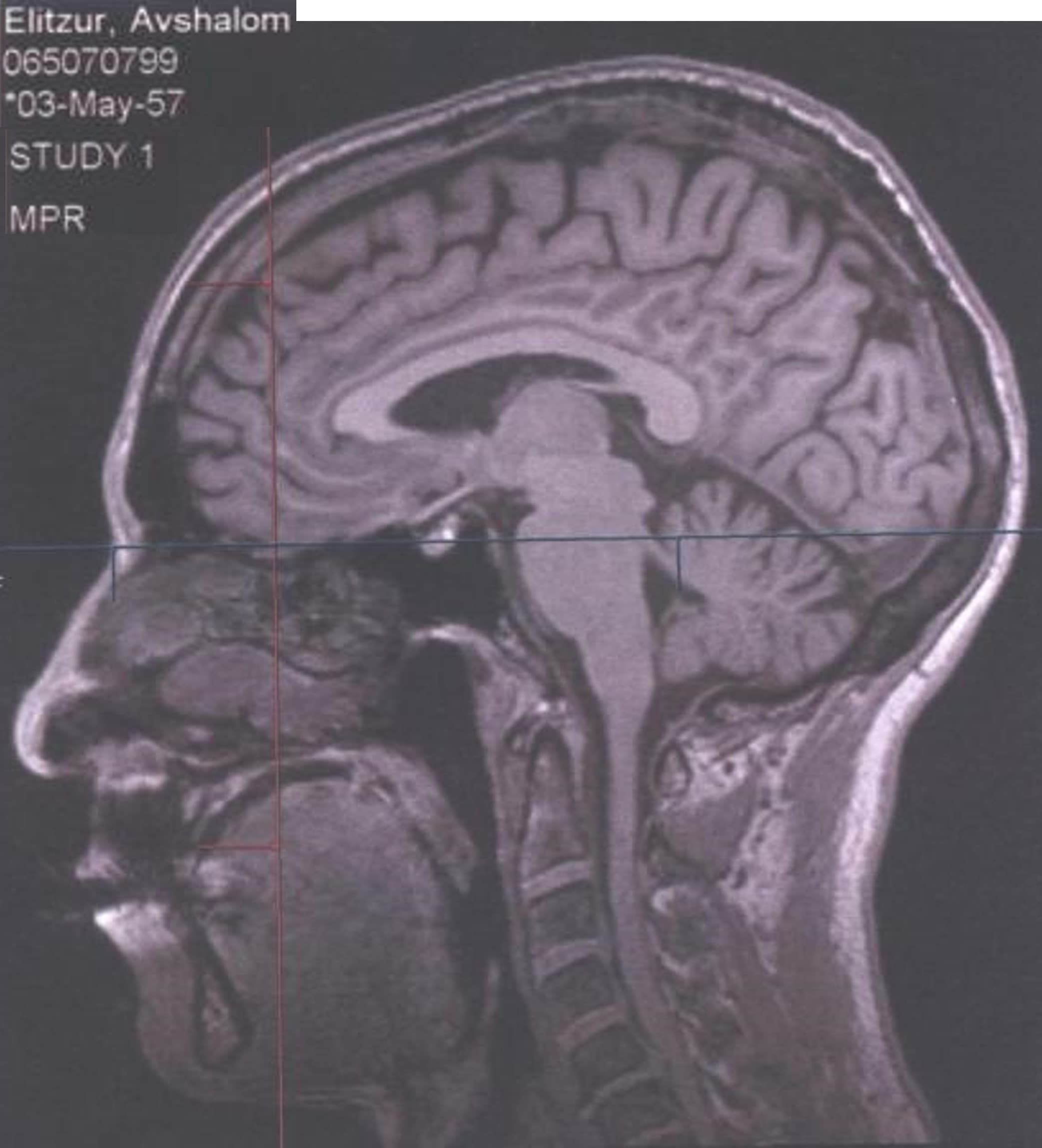 כשהמרצה מביא את המוח שלו לשיעור
